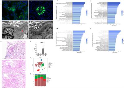 Integrated temporal transcriptional and epigenetic single-cell analysis reveals the intrarenal immune characteristics in an early-stage model of IgA nephropathy during its acute injury